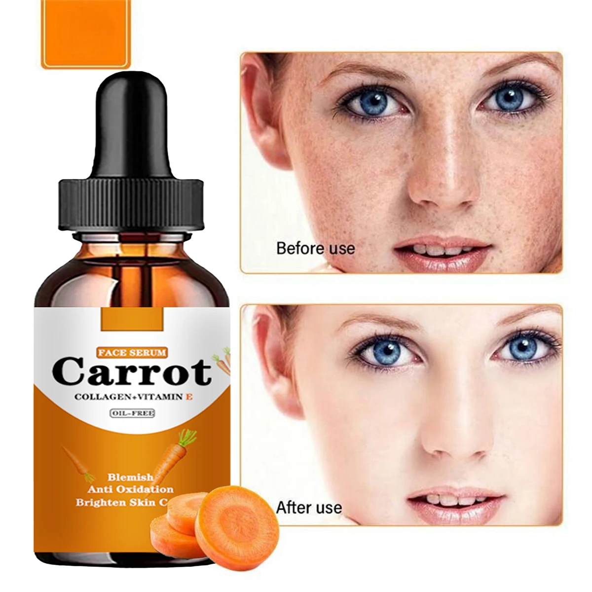 

New Carrot Essence Essential oils Dark Spot Corrector Face Whitening Serum Brighten Blemish Freckle Remover 100% Natural