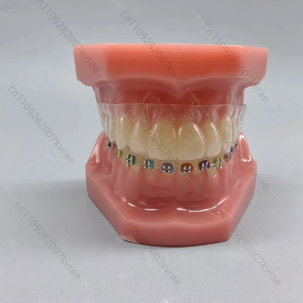 

B6 Teeth Display Model Teaching Model Steel Wire Transparent Braces Invisible Correction Demonstration Study Model