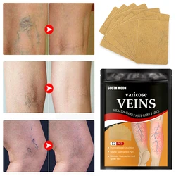 12/24/60pcs Varicose Veins Relief Patch Thigh Leg Pain Spider Removal Phlebitis Plaster Feet Anti Swelling for Foot Health Care