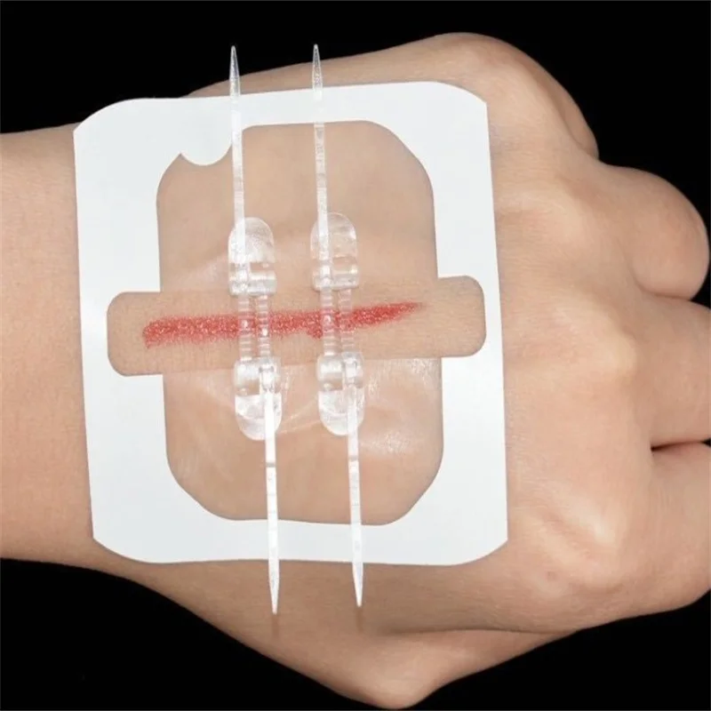 

New 2PCs/box Bandage Band Aid Zip Stitches Zip Tie Wound Closure Adhesive Suture-free