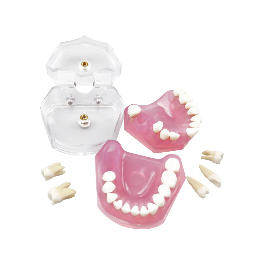 Dental Standard Typodont Teaching Model Removable Teeth Soft Gum Training Extraction Pratice Model Dentistry Study Demonstration