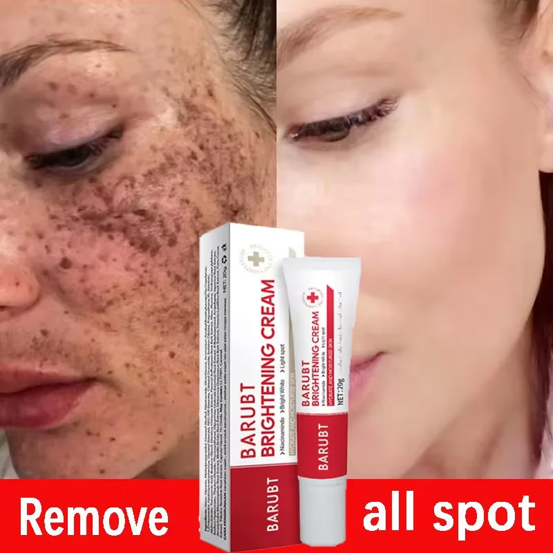 Effective Whitening Freckles Face Cream Removal Melasma Dark Spots Fade Melanin Pigmentation Corrector Brighten Repair Skin Care