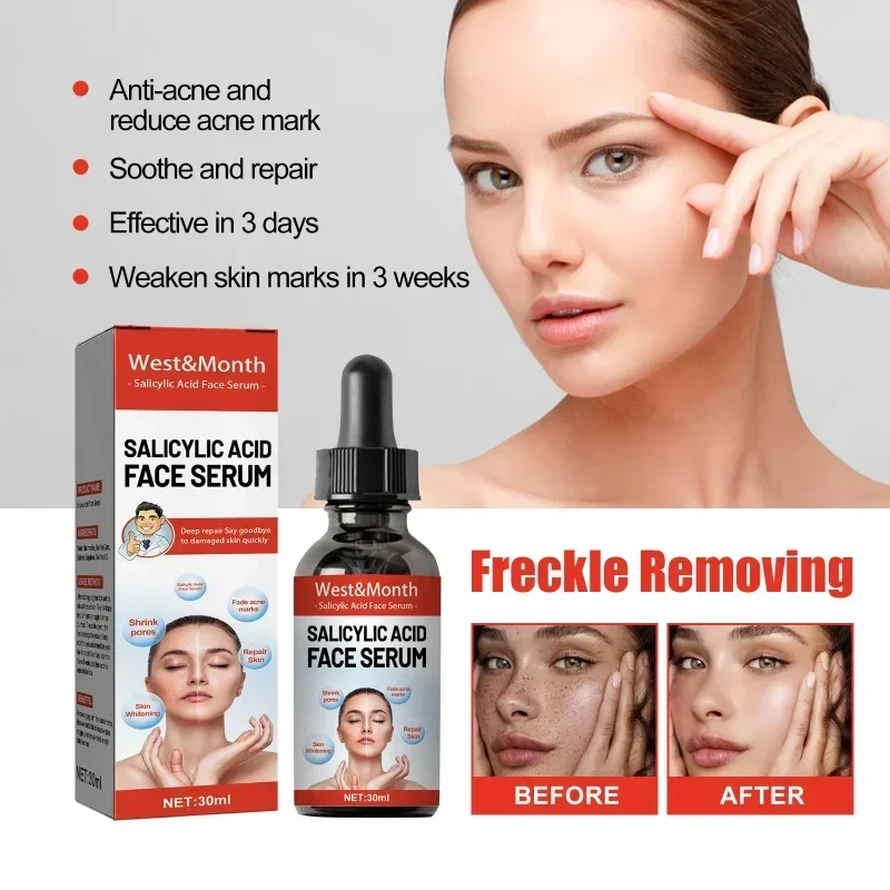 

SdatterSalicylic Acid whitening freckle Face Serum Fades Dark Spots Remove Melasma Shrinks Pores, Moisturizing Facial Essence Sk