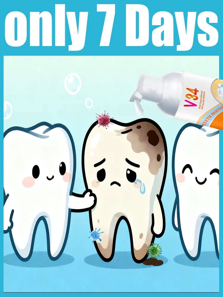 A mousse de proteção dentária atualizada de segunda geração repara rapidamente a cárie dentária