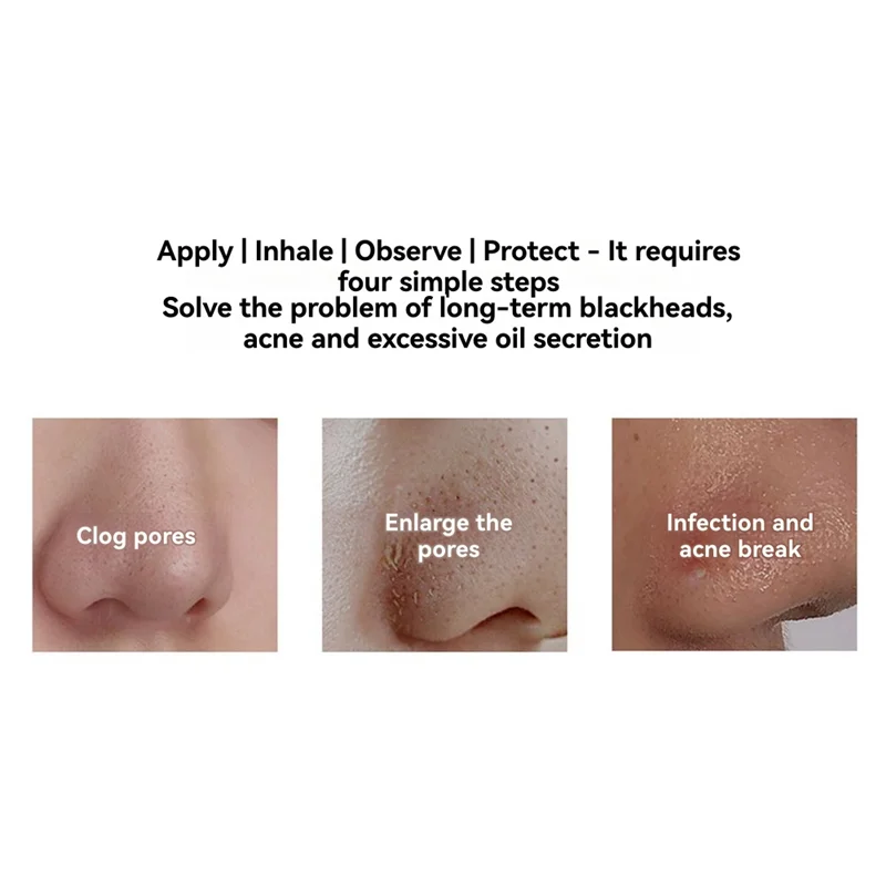 YCOC-블랙헤드 빨판 딥 클린 머신 가열식 여드름 제거제 블랙헤드 가열 페이스