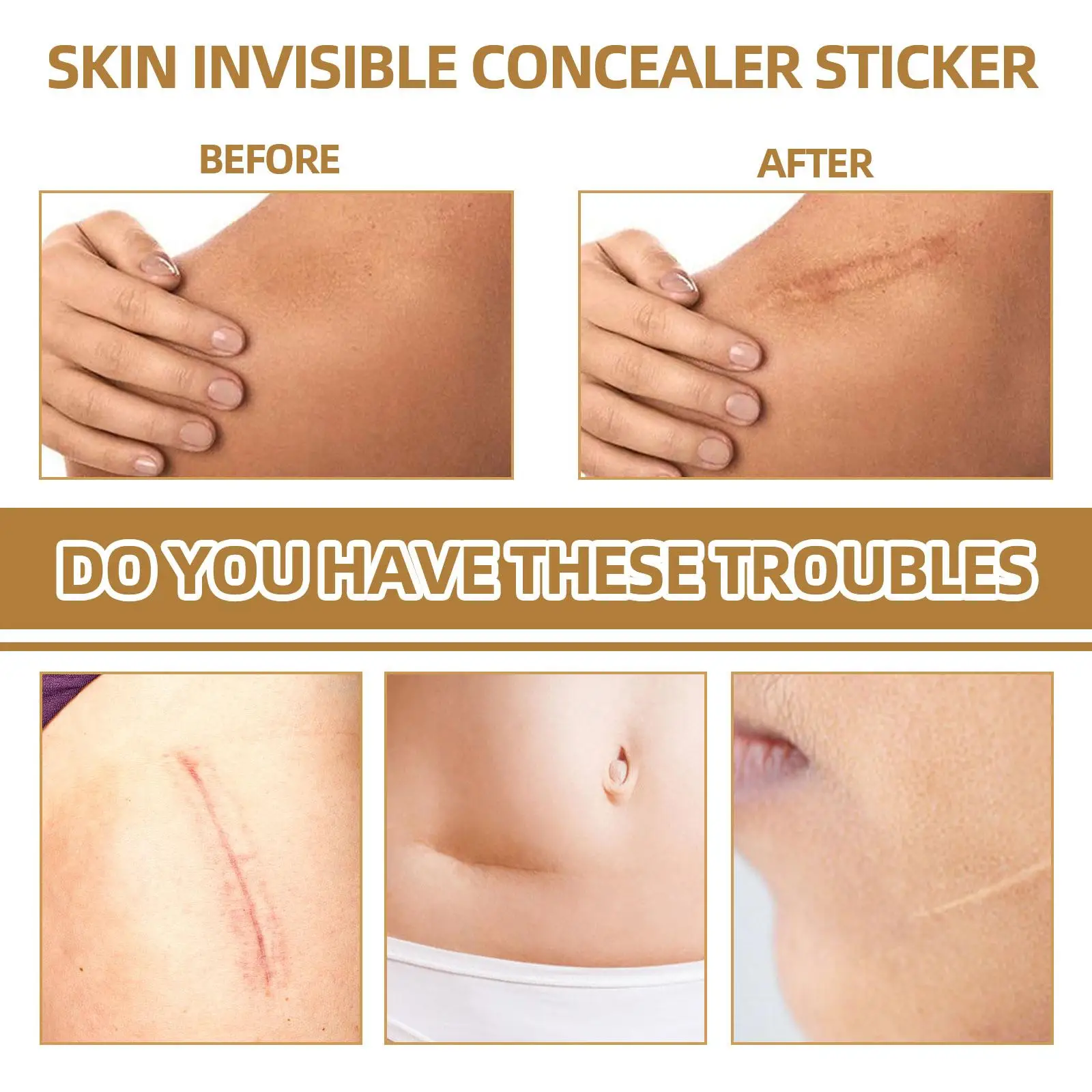 Skin Invisible Concealer Patch Sticker Breathable Tattoo Scar Cover Waterproof Skin-Friendly Simulation Skin Stick Makeup 2022