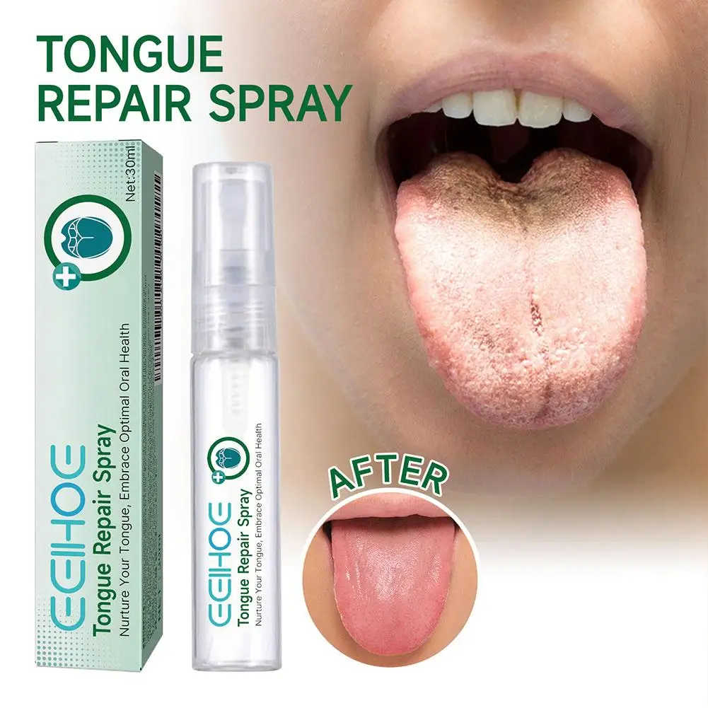 EELHOE Tongue Repair Spray Repair Tongue Whitening Dry, Oral Spray Cracked Care Swollen Relieve Tongue To And A0T7