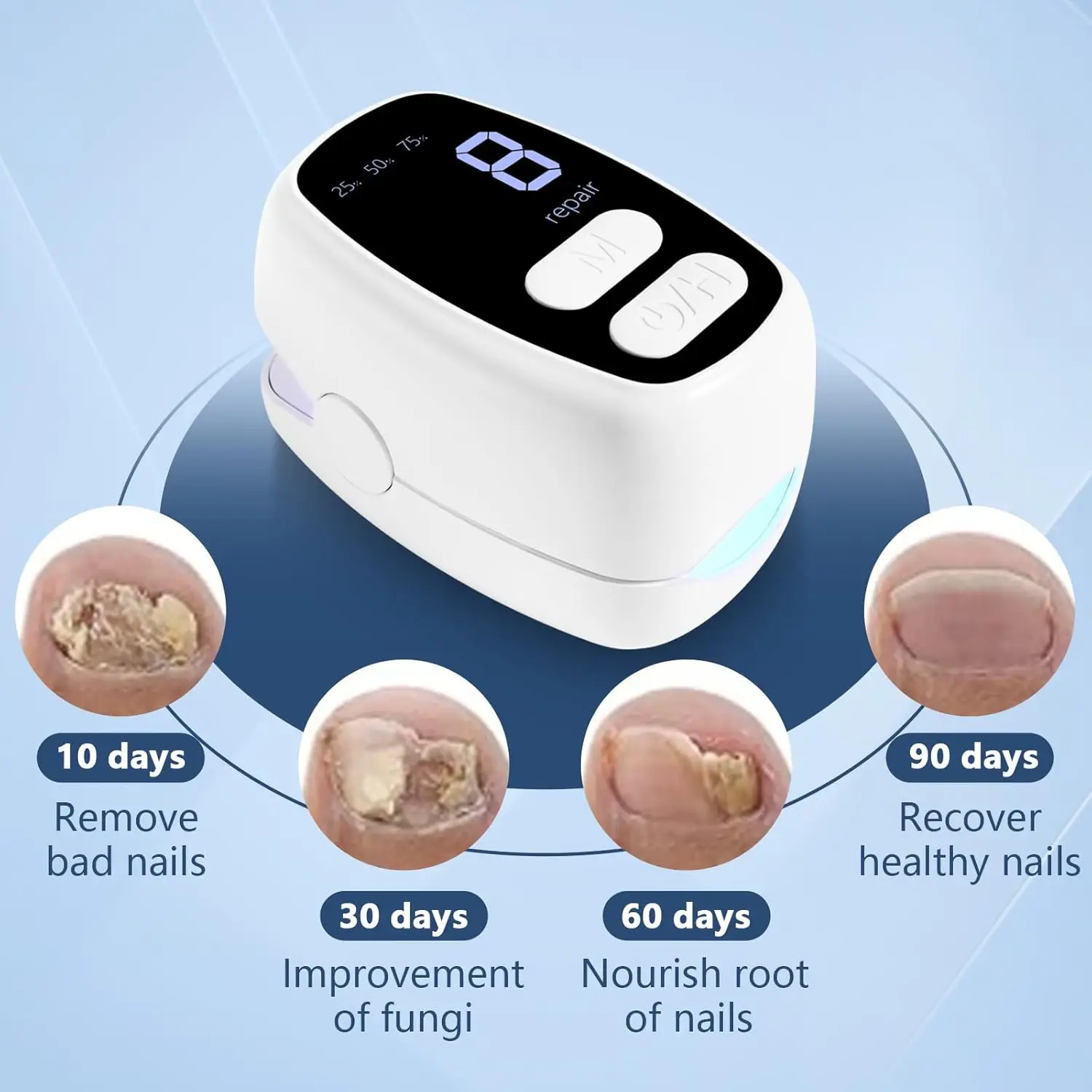 2-in-1 Nail Fungus Laser Device and Nail Art with Time&Battery Display 470+950nm wavelength Anti Fungal Laser Device for Toenail