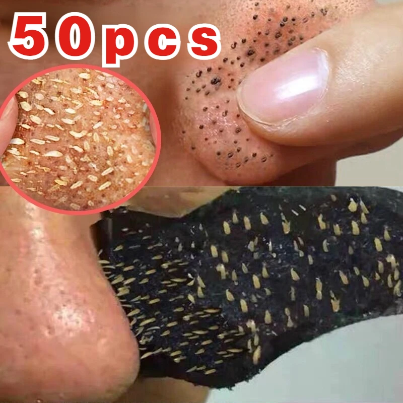 50pcs Nose Blackhead Remover Sticker Acne Treatment Mask Nose Sticker From Black Dots Cleaner Nose Pore Deep Cleaning Skin Care