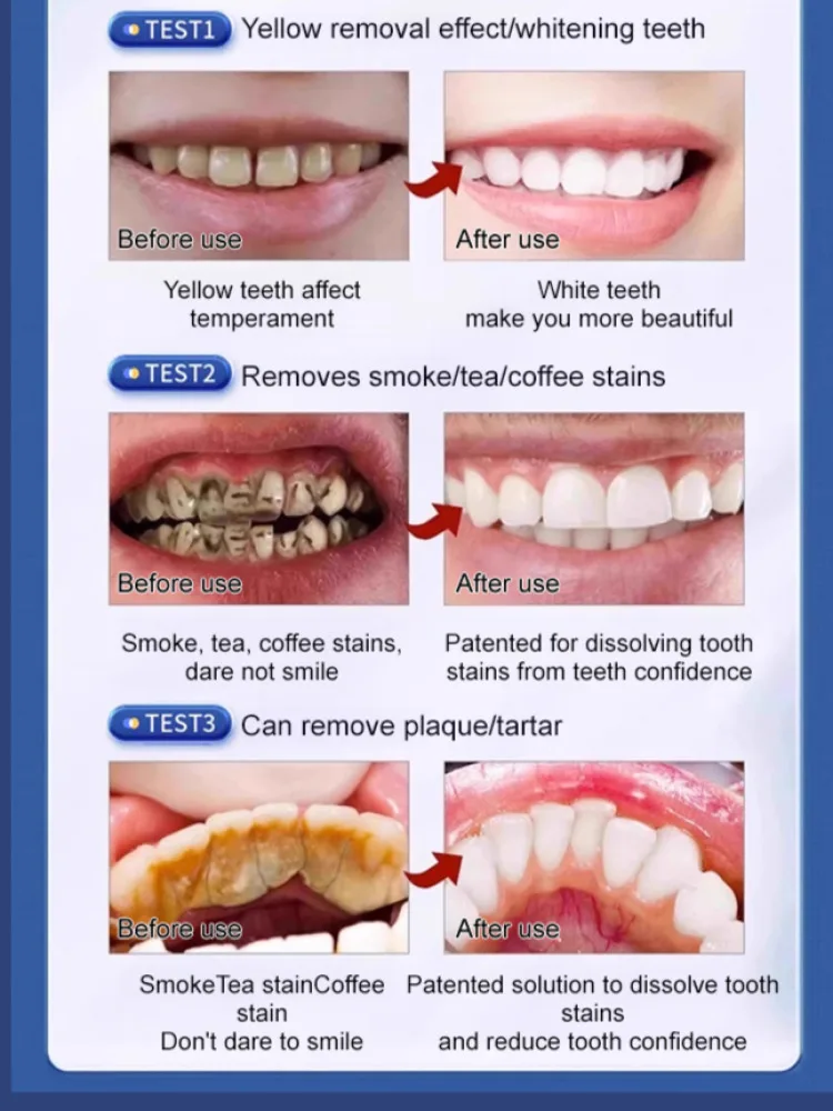 ยาสีฟันโปรไบโอติกแบบพกพาสำหรับเคี้ยวดูแลช่องปากและเคี้ยวได้ทำให้ลมหายใจสดชื่น