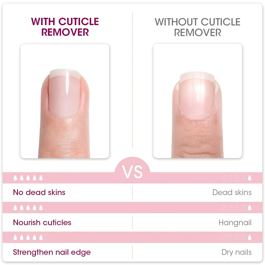 QAZIXU Nail Care Cuticle Remover Nail Polish Softener for Dead Skin Gel Manicure Treatment Tool or Pedicure Nails Care