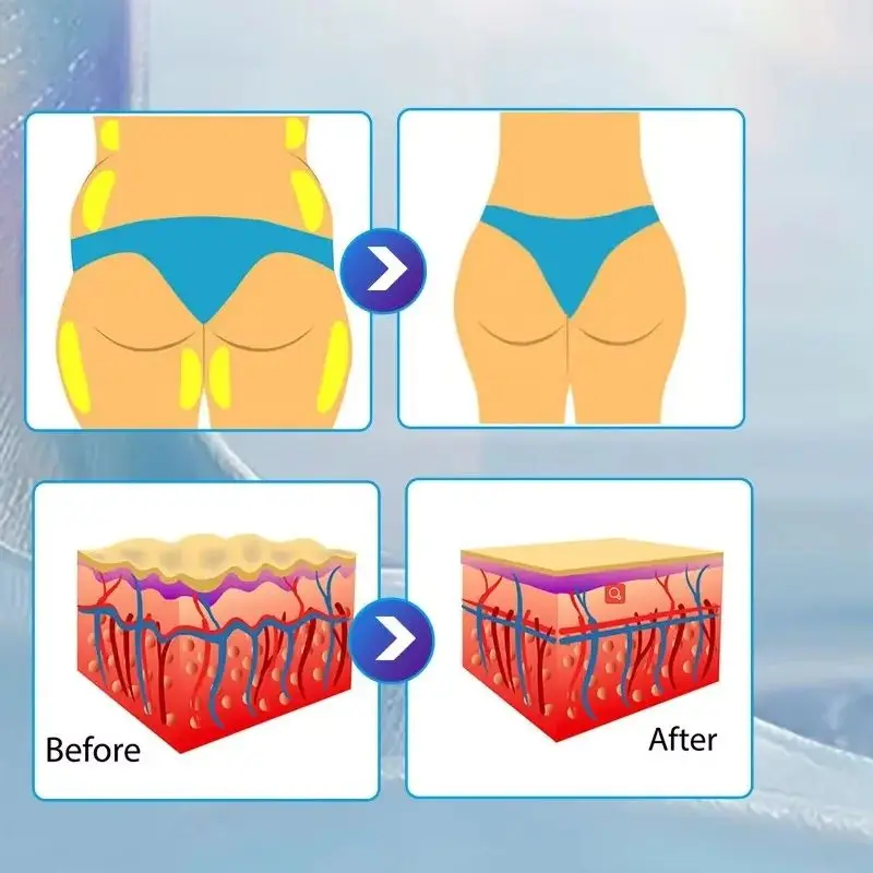 

New Slimming sculpt NEO Nova 15 Tesla Power 6500W hi-emt 4 pcs Handles With Pelvic Stimulation Pads Optional