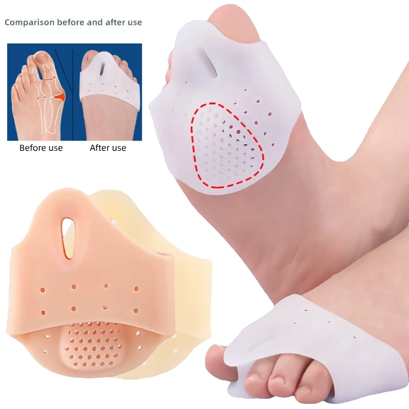 2pieces=1pair Overlapping Toe Hallux Valgus Gel Forefoot Pads Toe Separator Cushion Silicone Insole Bunion Corrector Pain Relief