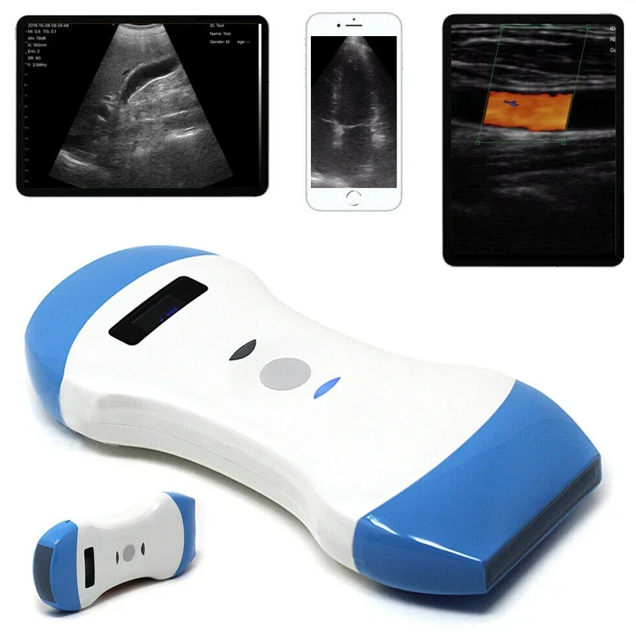 3 in 1 Wireless Cardiac Ultrasound Scanner Machine Convex / Linear Phased Array probe