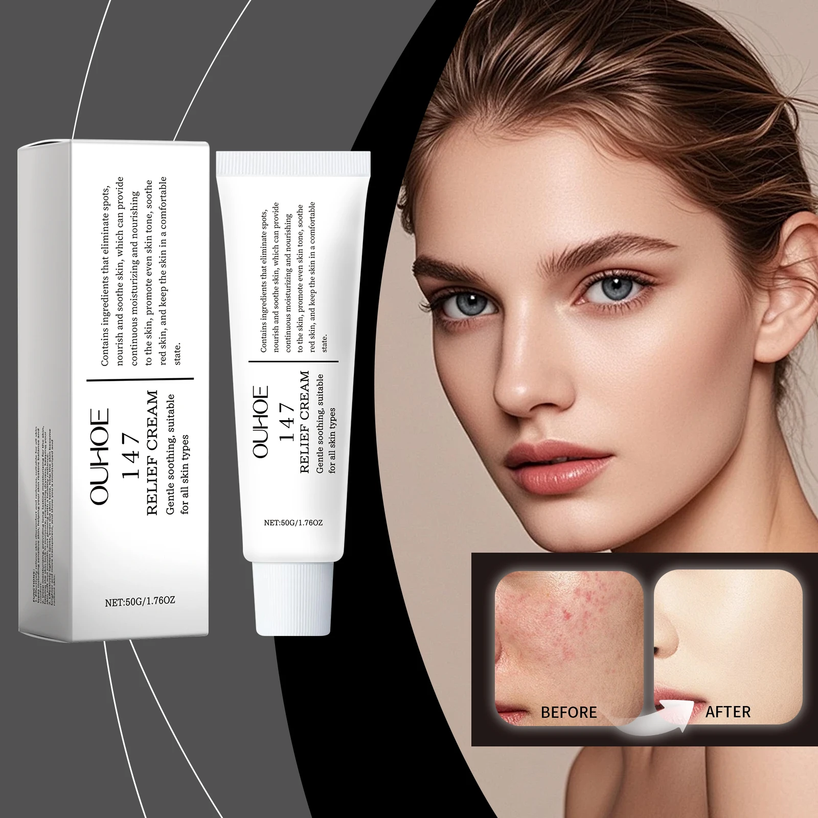 Crema Sollievo - Crema Viso Correttrice e Lenitiva delle Macchie, Trattamento delle Macchie Scure con Formula Nutriente per Anche Il Tono Della Pelle