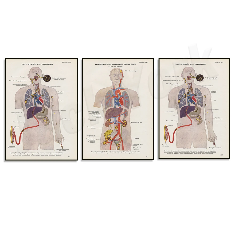 طباعة الرحل الطبية من عام 1952، ملصق تشريح الرحلان، هدية لقسم رئوي لتزيين مكتب الطبيب #1