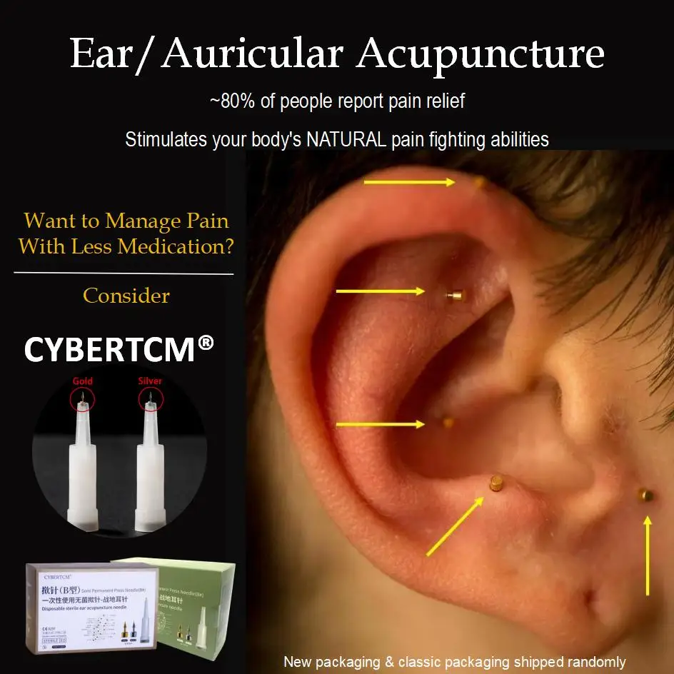 offre-speciale-–-aiguilles-d'acupuncture-jetables-en-acier-inoxydable-de-qualite-medicale-200-pieces-pour-points-auriculaires-et-zones-de-combat