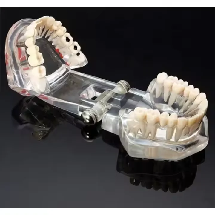Denture Simulation Model for Oral Pathology Stomatology Teaching and Doctor-patient Communication Practice
