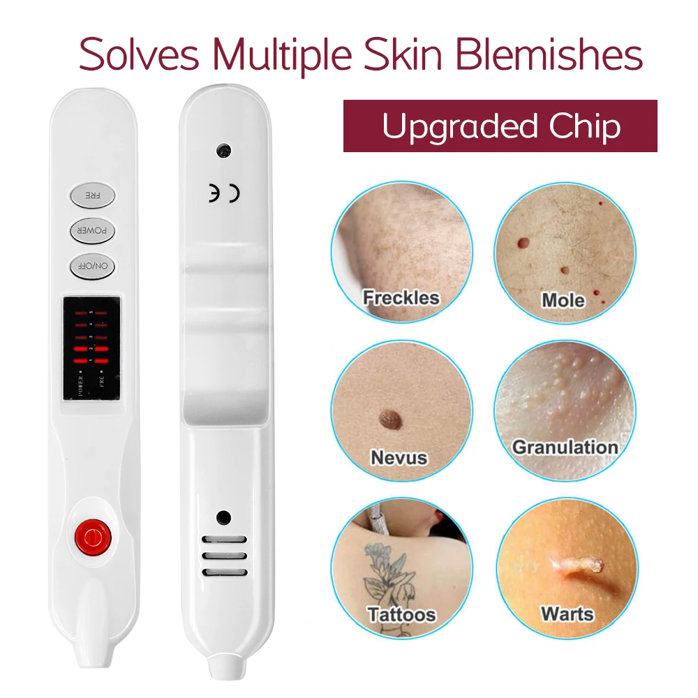 Professioneller Plasma-Pen zur Entfernung von Sommersprossen, Falten, Muttermalen, Tattoos, Mitessern, dunklen Flecken und Pigmenten, Hautpflegegerät, ionischer Schönheitsstift – Detail 12