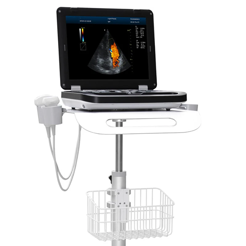 Products subject to negotiationPortable Ultrasound Auto IMT Color Doppler Ultrasound Machine ecografo sonoscape