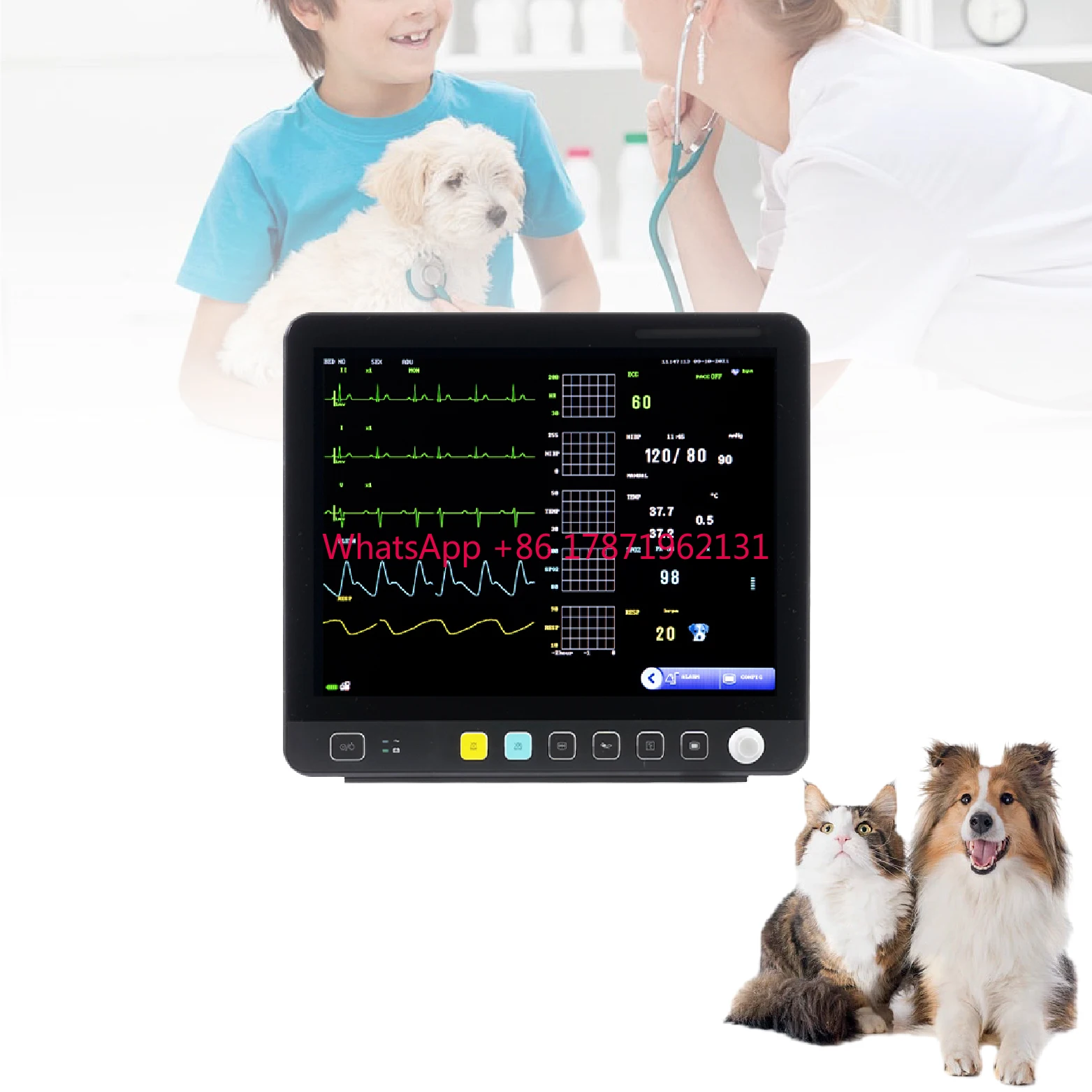 Electro Cardiscope Monitor Veterinary Hospital Clinic Icu Surgery Multi Parameter Vital Signs Monitor