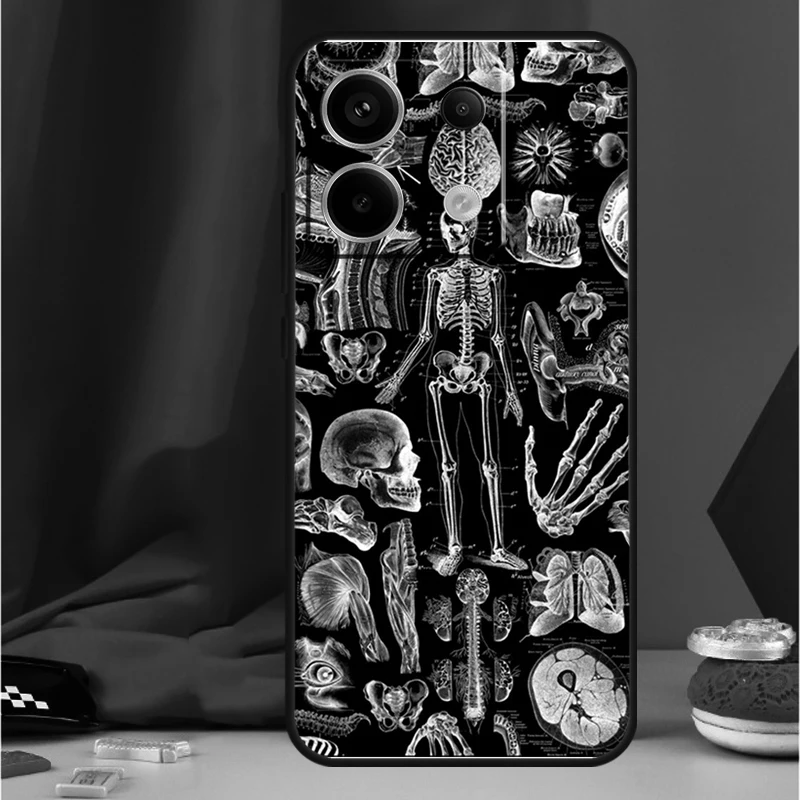 X-Ray 인체 해부학 케이스 Xiaomi Redmi Note 11 12 13 Pro 8 9 10 Note 12S 11S 10S 9S Redmi 13C 10C 12C 커버