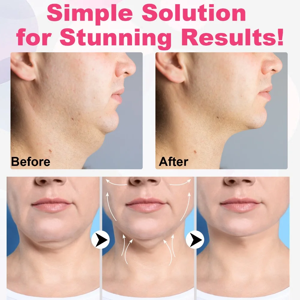 Breathable Face Slimming BANDAGE Chin Cheek Lift UP เข็มขัดผู้หญิง V Line Face Shaper นวดหน้าสายคล้อง Skin Care เครื่องมือความงาม