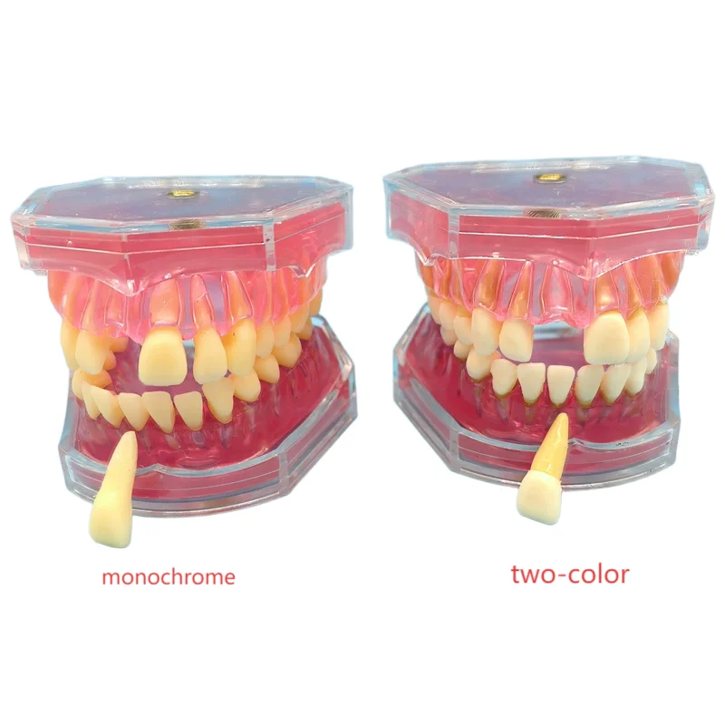 Dental Tooth Model Soft Gum Study Teaching Molding Standard with 28 Pcs Removable Teeth Dentistry Demonstration Accessories