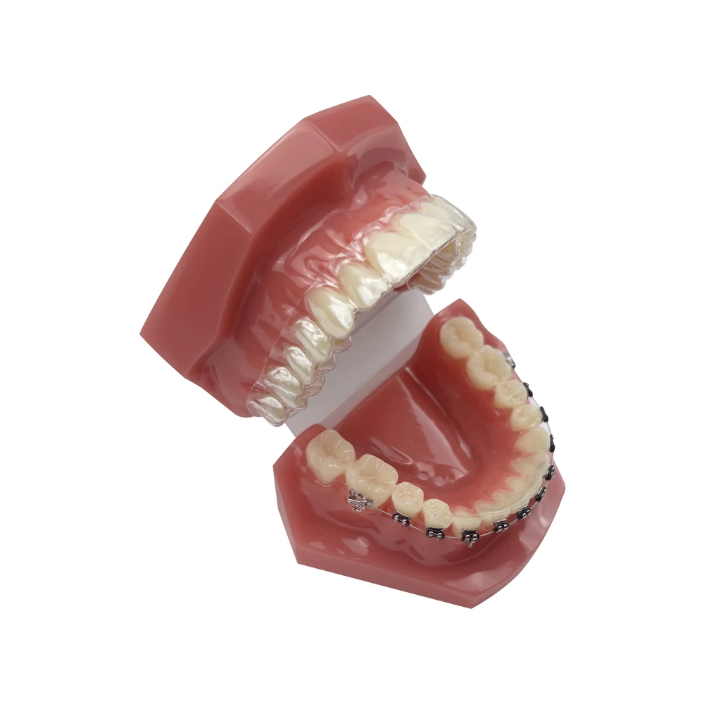 Modelo de dientes de ortodoncia Dental con retenedor, soporte Invisible, modelo de enseñanza Typodont para demostración de entrenamiento de odontología, 1 Uds.