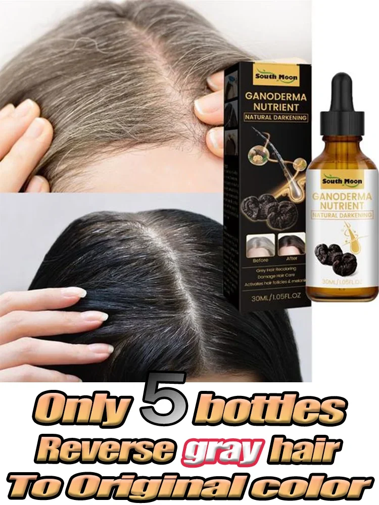 10PCS Gray White Hair Treatment Serum Liquid White To Black Natural Color Repair Nourish Product Anti Loss Hair Care Men Women