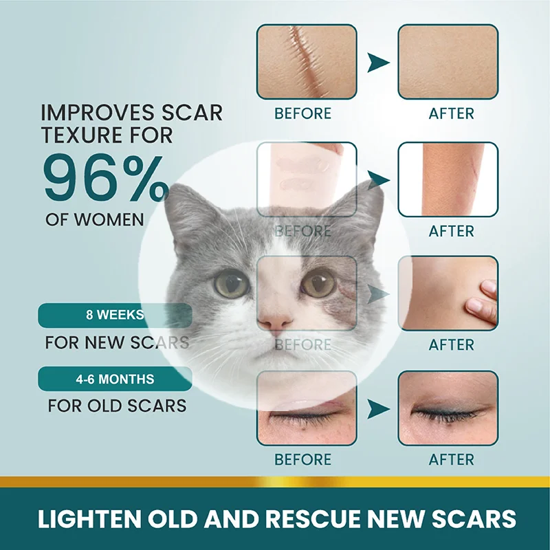 

1 Roll Silicone Scar Sheets Gel Scar Patch 4cmX150cm Self-Adhesive Scar Cover Tape Reusable And Effective Skin Care Strips