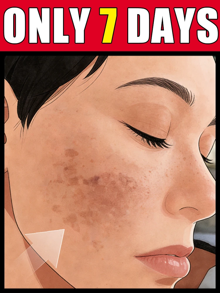 

Поколение 2: Уменьшите свои заботы и перестаньте постоянно беспокоиться о меланине кожи лица. Хит продаж!