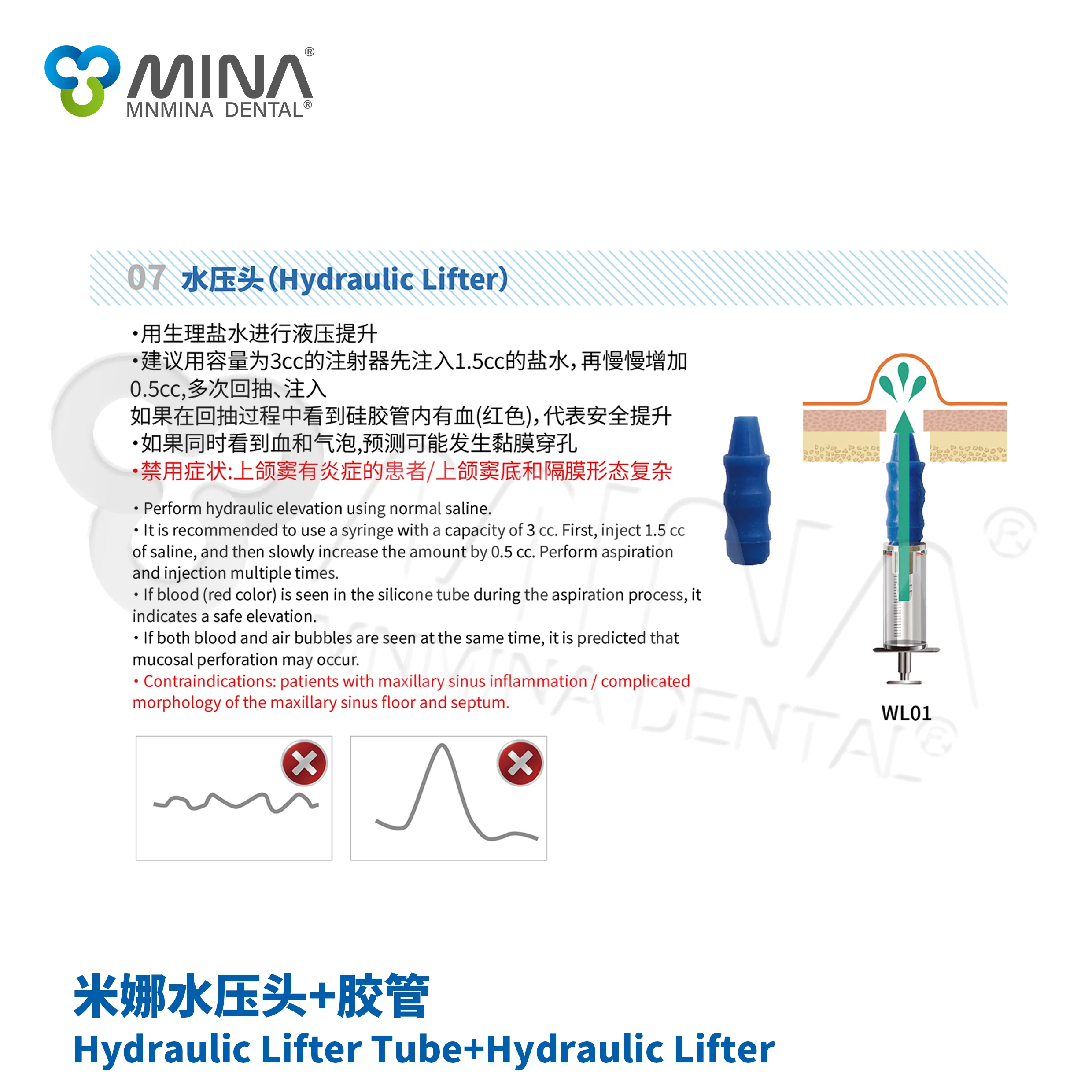 Mina Dental Hydraulic Lifter Set for Surgical Implant Instruments Manual Power Source Tube*3