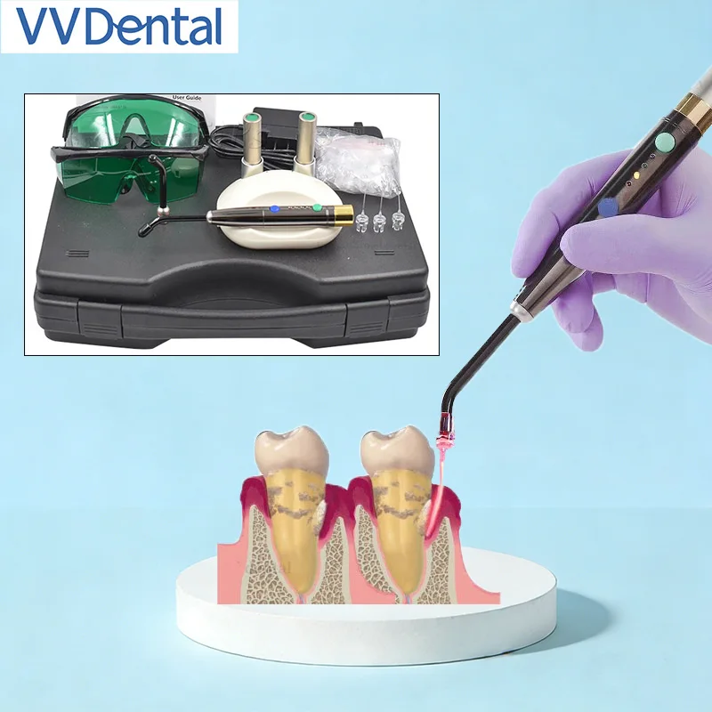 

Портативный стоматологический диодный лазер F3WW, низкоинтенсивный лазер 650 нм, перезаряжаемый, для лечения в стоматологии, со звуковым оповещением