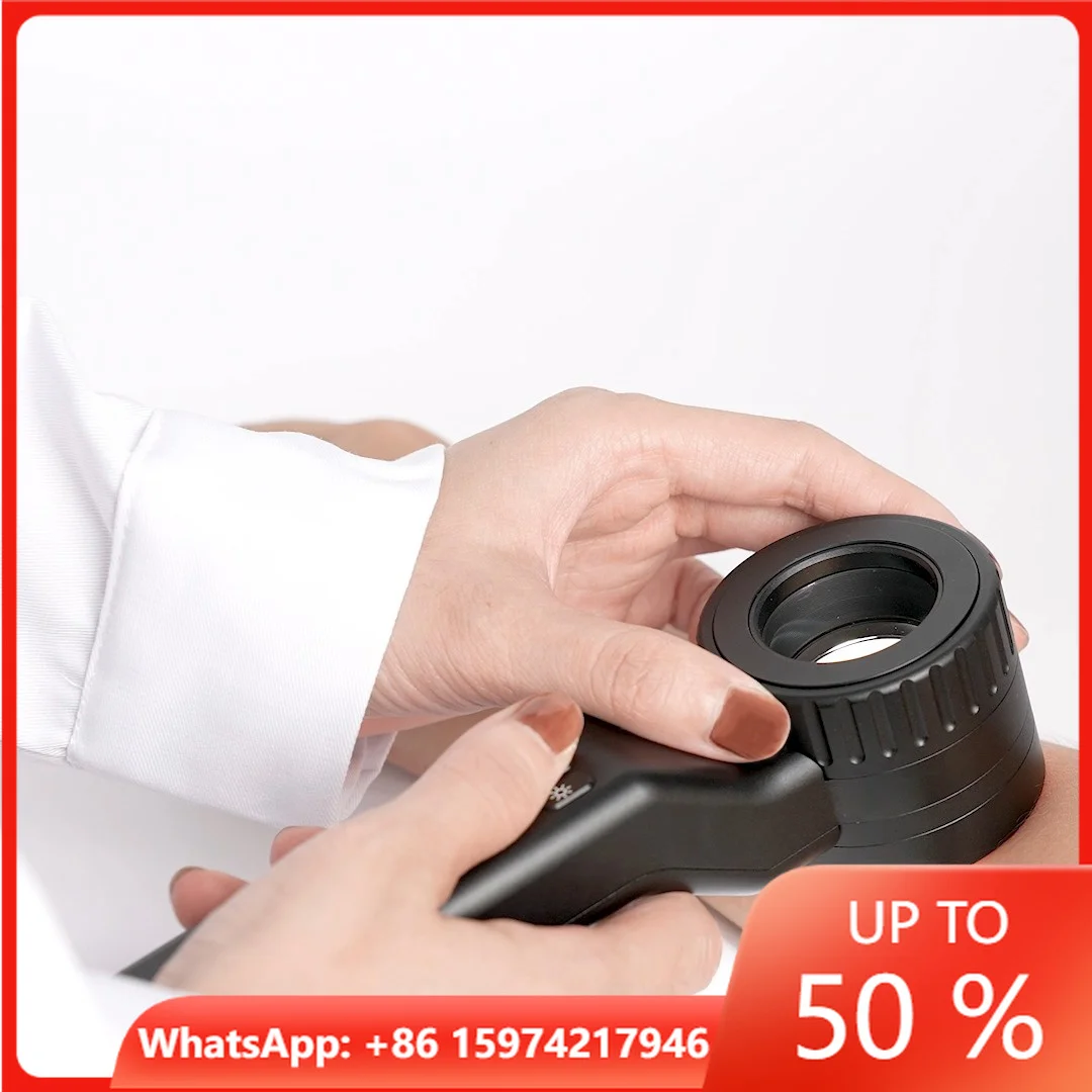 IBOOLO DE-4100 The World's Best Handheld Dermoscope For Melanoma Diagnosis