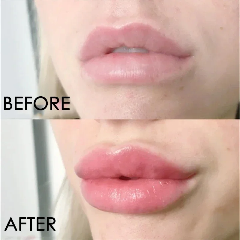 Instant Lip Plumper Serum Extreme Volumising Enhancer Lip Gloss Nourish Increases Lip Elasticity Sexy Fuller Lips Care Cosmetics