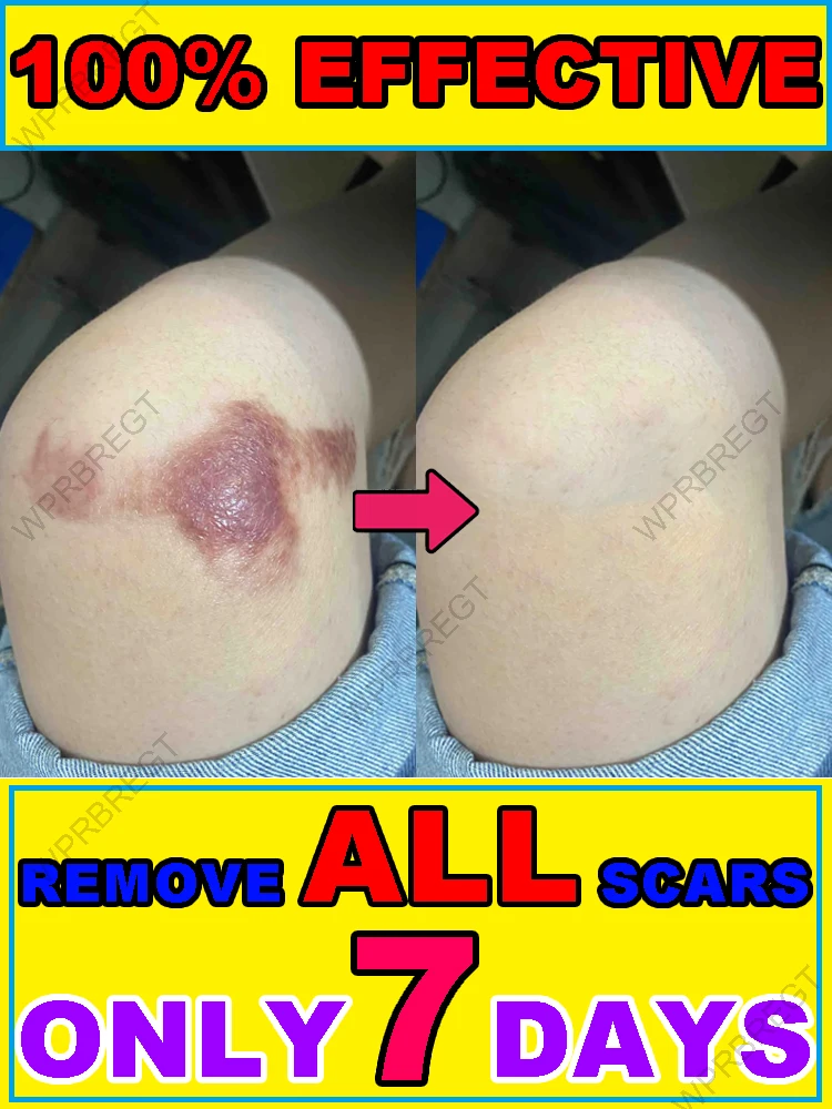 Lassen Sie Ihre Haut frei atmen!