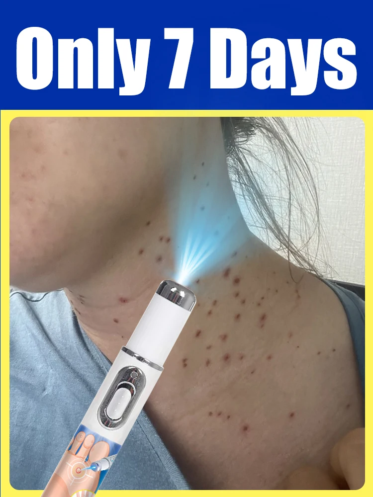 

Specializes in dealing with the particularly stubborn old warts, which can be repaired with roots and will fall off soon