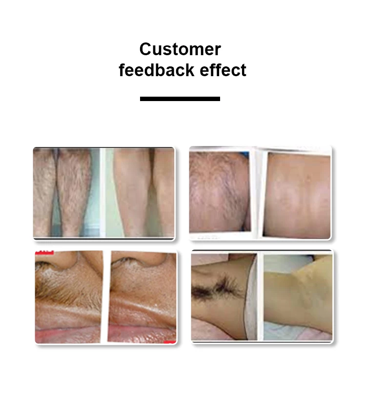 3 أطوال موجية شاشة مزدوجة ديود آلة إزالة الشعر بالليزر مقبض نظام ذكي لنزع الشعر الفعال مع شاشة -28 ℃   التبريد