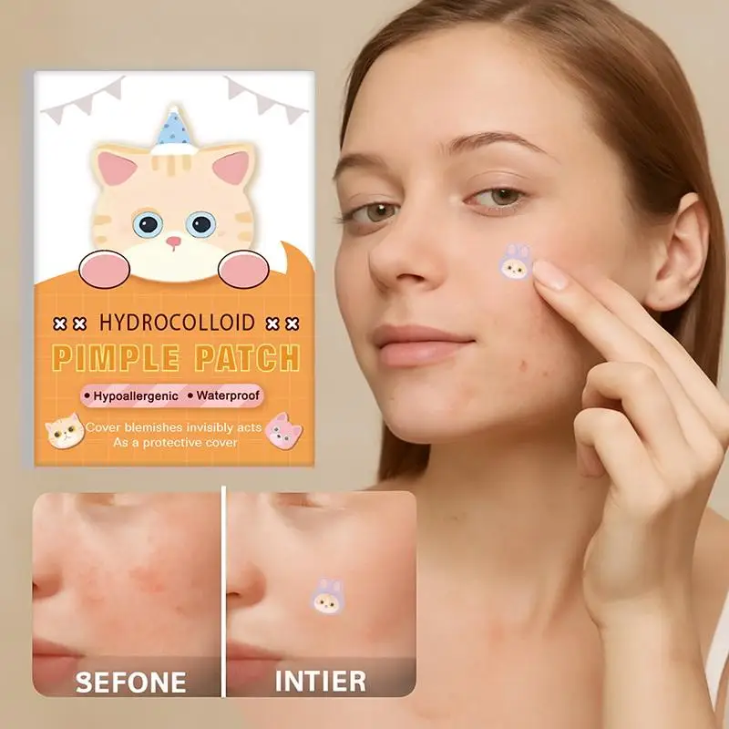 600 Pcs Acne Patches Cat Shaped Acne Treatment Sticker Colorful Acne Cover Removal Pimple Patch Anti-Acne Hydrocolloid Sticker