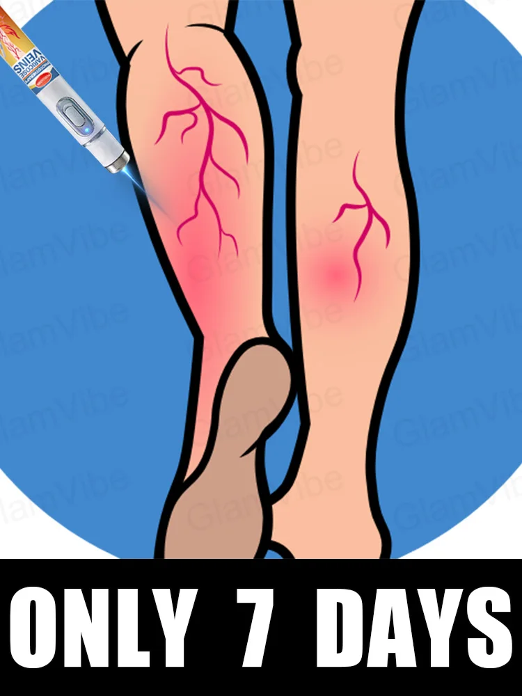 

blue light pen solve varicose veins, hot sale leg care tools