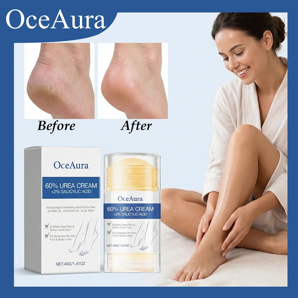 

Крем с мочевиной OCEAURA 40G, глубокое проникновение, восстанавливает поврежденные барьеры кожи, мягко и эффективно удаляет мозоли и огрубевшую кожу.