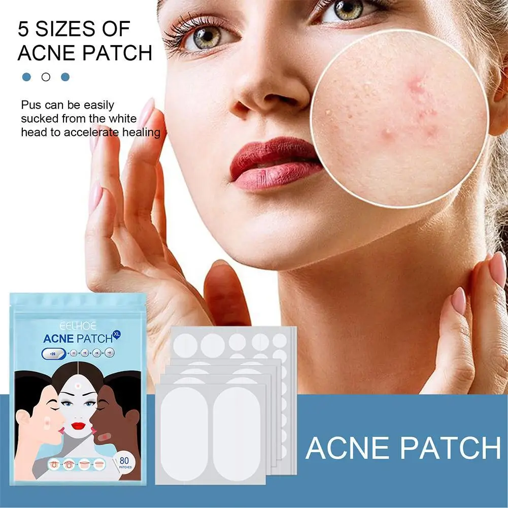 Tamanho Grande Acne Pimple Patch, Removedor De Tratamento De Rosto, Adesivos, Espinhas Invisíveis, Ferramentas De Manchete, 80Pcs, Conjunto