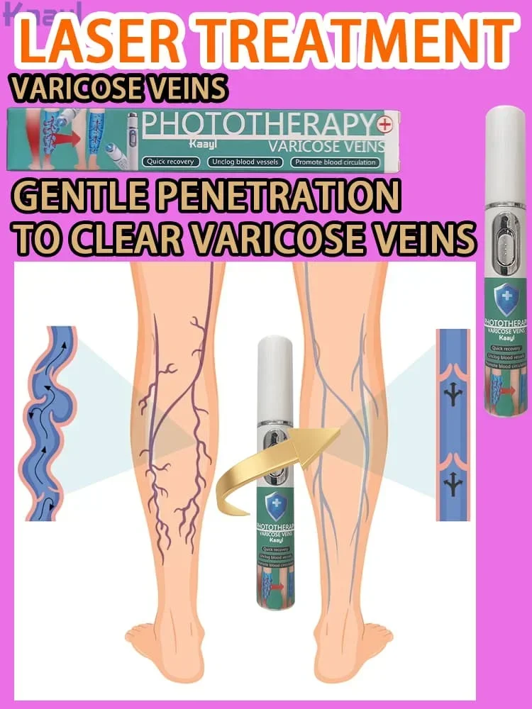 

Improves Blood Circulation | Support Circulation for Vein Health, Strength, and Function | Blue Light Laser