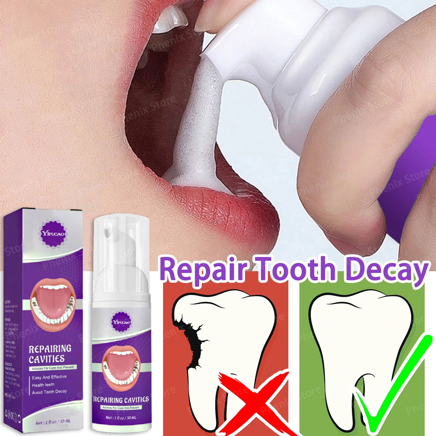 Dental Caries Repair Serum Prevent Tooth Decay Protect Teeth Remove Plaque Oral Cleaning Natural Herbal Extract 30ml