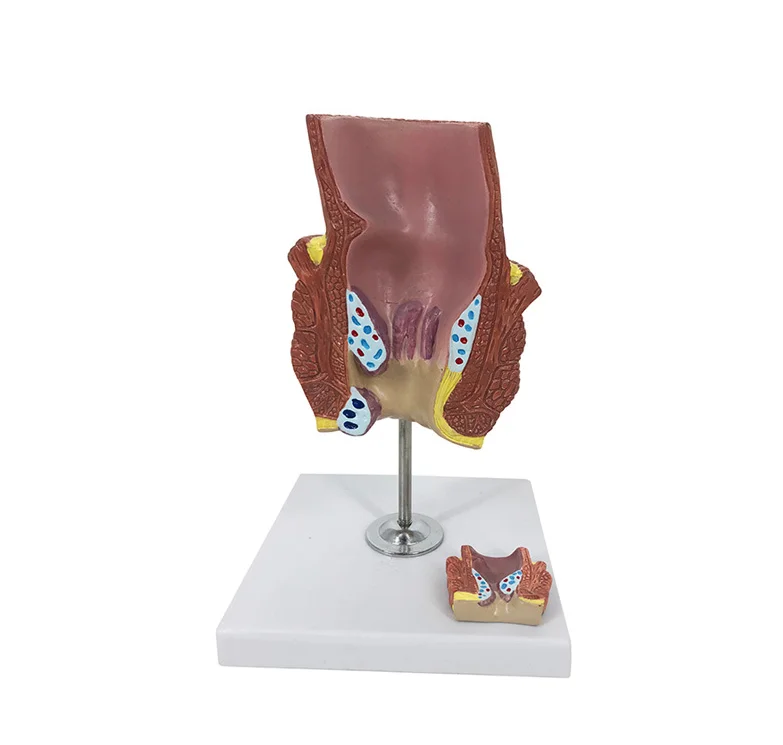 

Polyvinyl chloride hemorrhoid anatomy model medical training aids