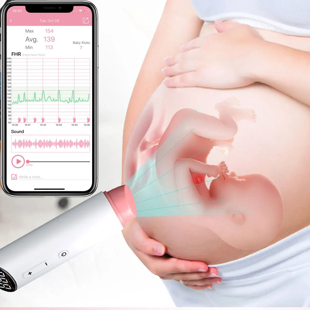 Doppler fœtal Bluetooth aste à ultrasons, moniteur cardiaque fœtal pour femme enceinte, bébé, enregistrement vocal, 0 rayonnement