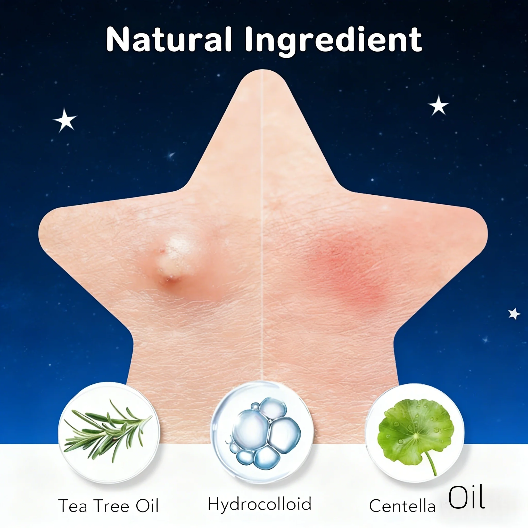 Toppe per l'acne HITWORKER da 252/504/1008 pezzi |   Copertura invisibile per imperfezioni, arricchita con olio di albero del tè, pulizia delicata