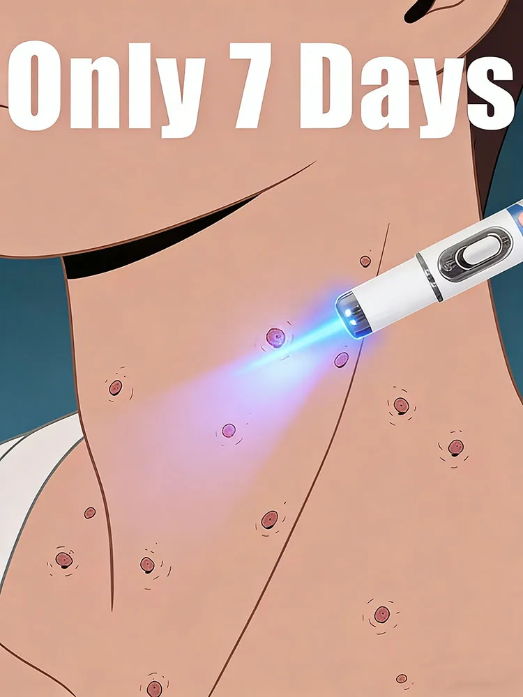 

Blue light wart removal tools to improve your life. Buy in sets for even greater savings.