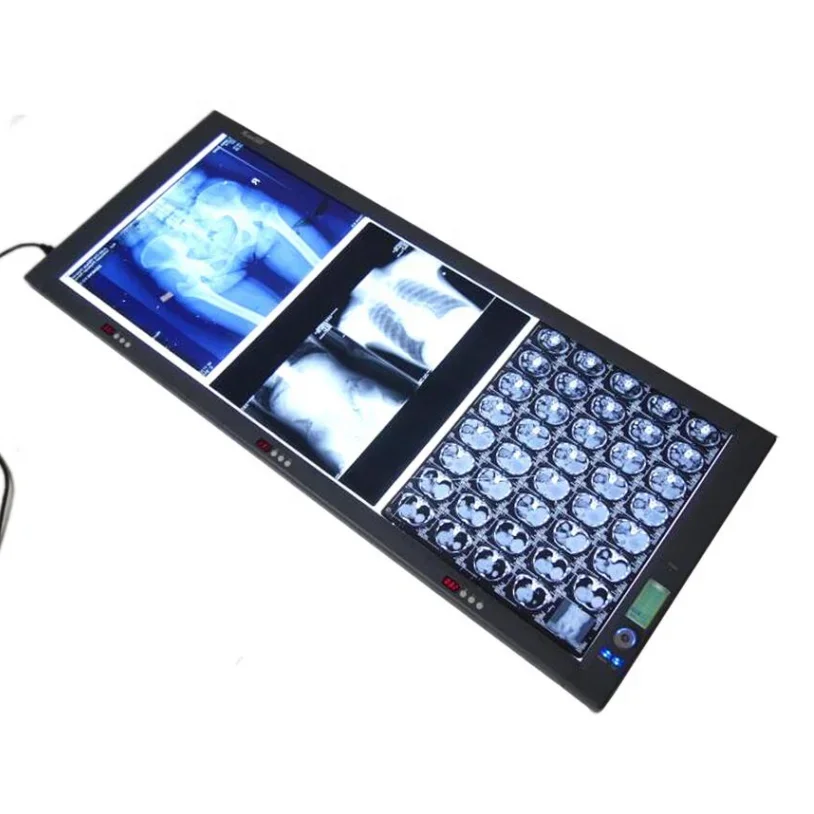2026/X-ray LED Triple Film Viewer Radiographic Film Viewer Medical led Negatoscope